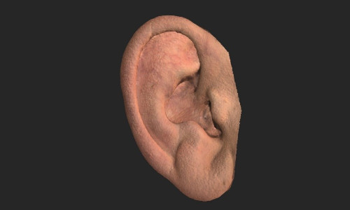 Scan of the auricle